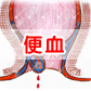 大便发黑是什么原因？大