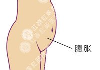 腹胀百科