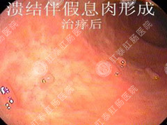 下消化道出血怎么办？