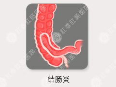 慢性结肠炎是什么样的