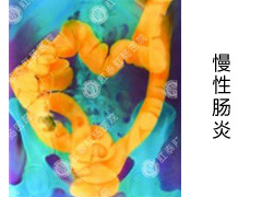 慢性肠炎要怎么检查？